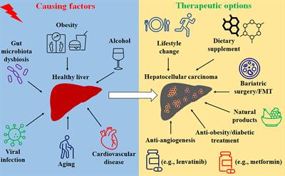 Hepatocellular Carcinoma and Obesity, Type 2 Diabetes Mellitus, Cardiovascular Disease: Causing Factors, Molecular Links, and Treatment Options